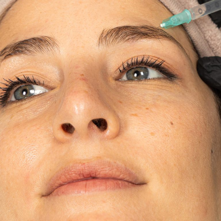 Botox TOP IMAGE new 2