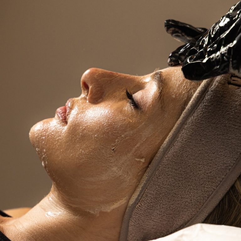 Facials Peels TOP IMAGE new
