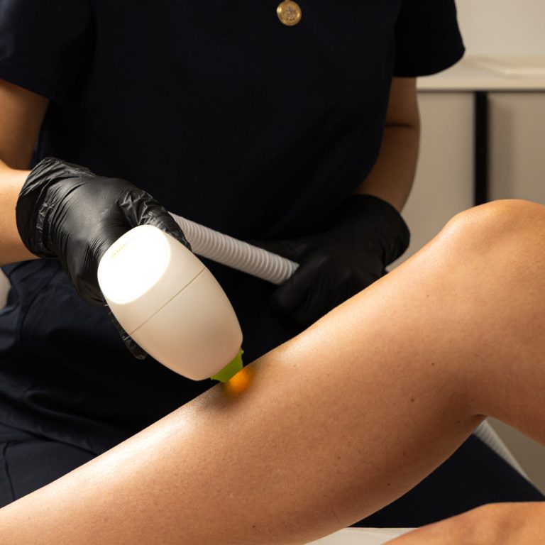 Hair Removal TOP IMAGE New